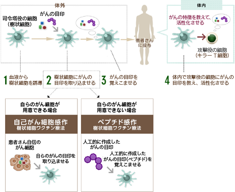 樹状細胞ワクチン療法